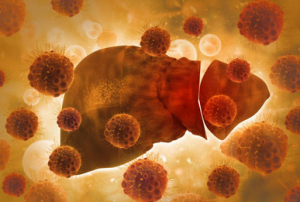 Liver Cancer